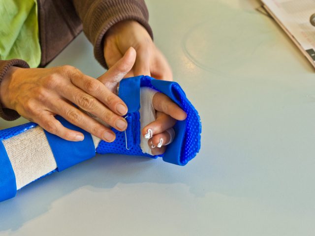 Professional Physical Therapy - Custom Splinting vs. Casting